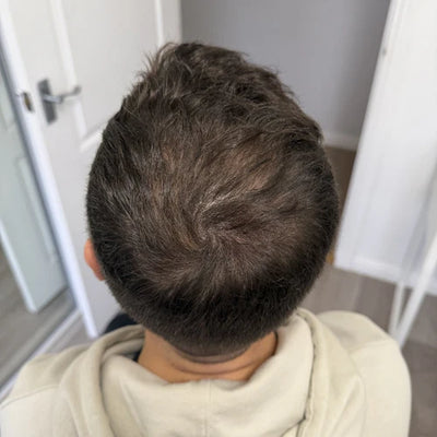 After