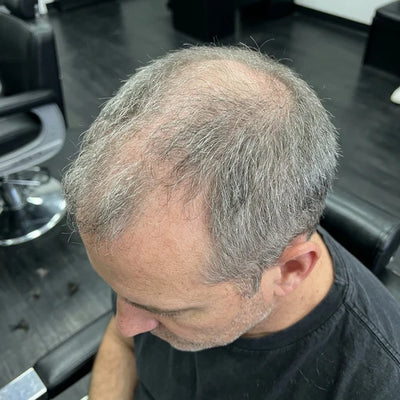 Before